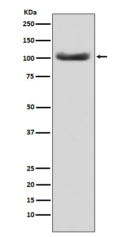Anti-MSH2 Monoclonal Antibody Boster Bio