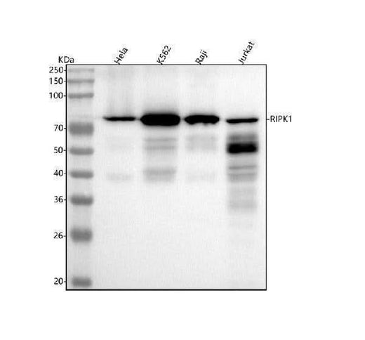 Anti-RIP RIPK1 Rabbit Monoclonal Antibody Boster Bio