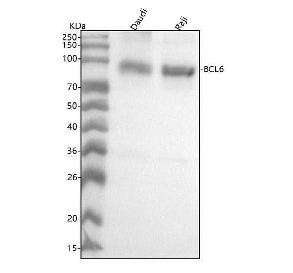 Anti-Bcl-6 Rabbit Monoclonal Antibody Boster Bio