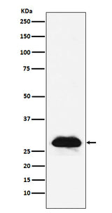 Anti-Carbonic anhydrase 2 Rabbit Monoclonal Antibody Boster Bio