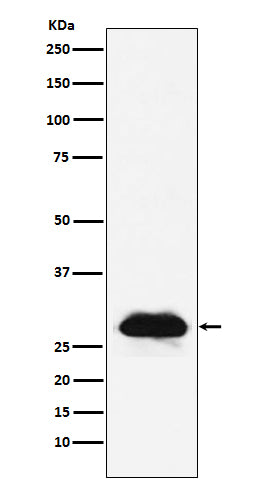 Anti-Carbonic anhydrase 2 Rabbit Monoclonal Antibody Boster Bio