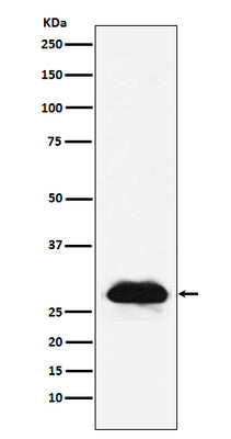 Anti-Carbonic anhydrase 2 Rabbit Monoclonal Antibody Boster Bio