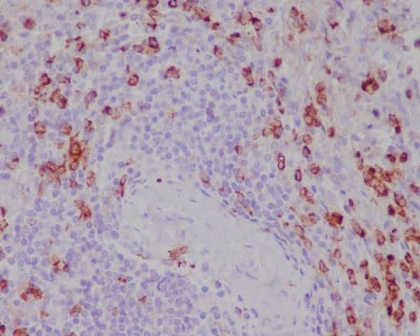 Anti-CD11b ITGAM Rabbit Monoclonal Antibody Boster Bio
