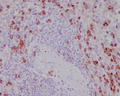 Anti-CD11b ITGAM Rabbit Monoclonal Antibody Boster Bio