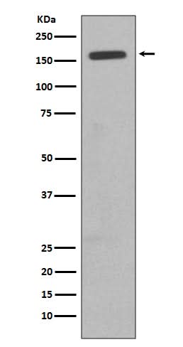 Anti-CD11b ITGAM Rabbit Monoclonal Antibody Boster Bio