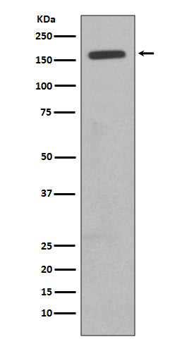 Anti-CD11b ITGAM Rabbit Monoclonal Antibody Boster Bio