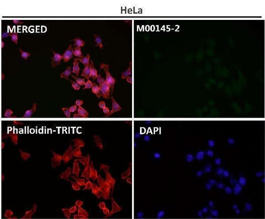 Anti-p21 CDKN1A Rabbit Monoclonal Antibody Boster Bio