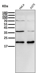Anti-p21 CDKN1A Rabbit Monoclonal Antibody Boster Bio