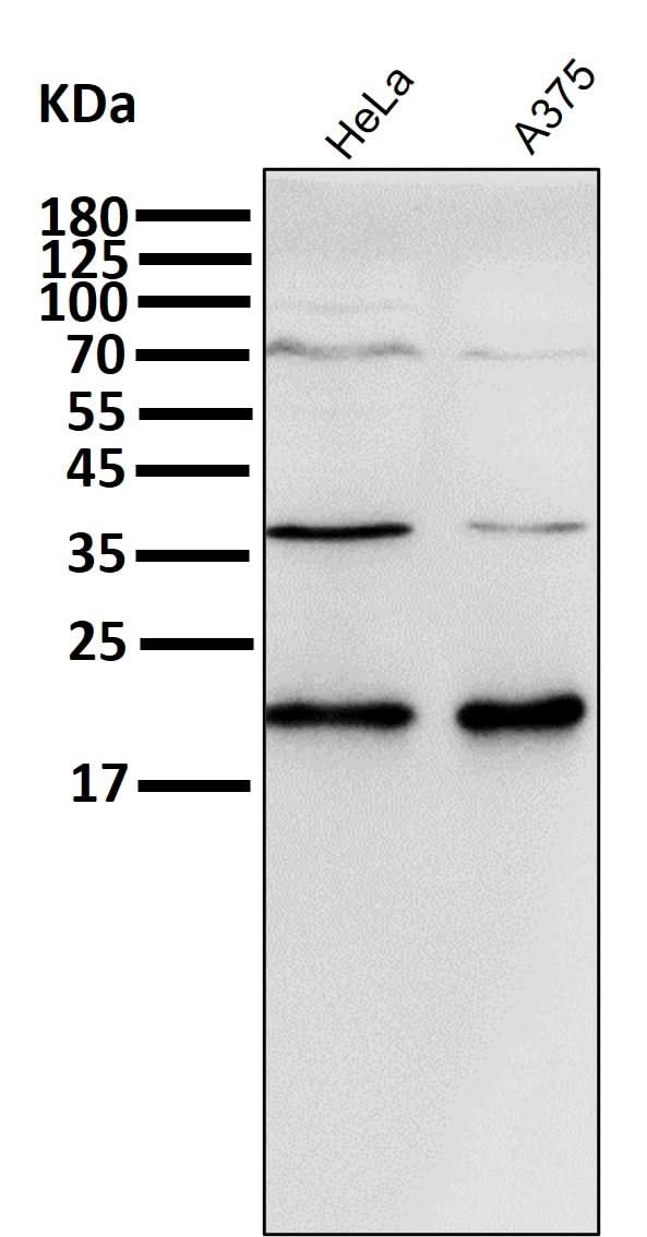 Anti-p21 CDKN1A Rabbit Monoclonal Antibody Boster Bio