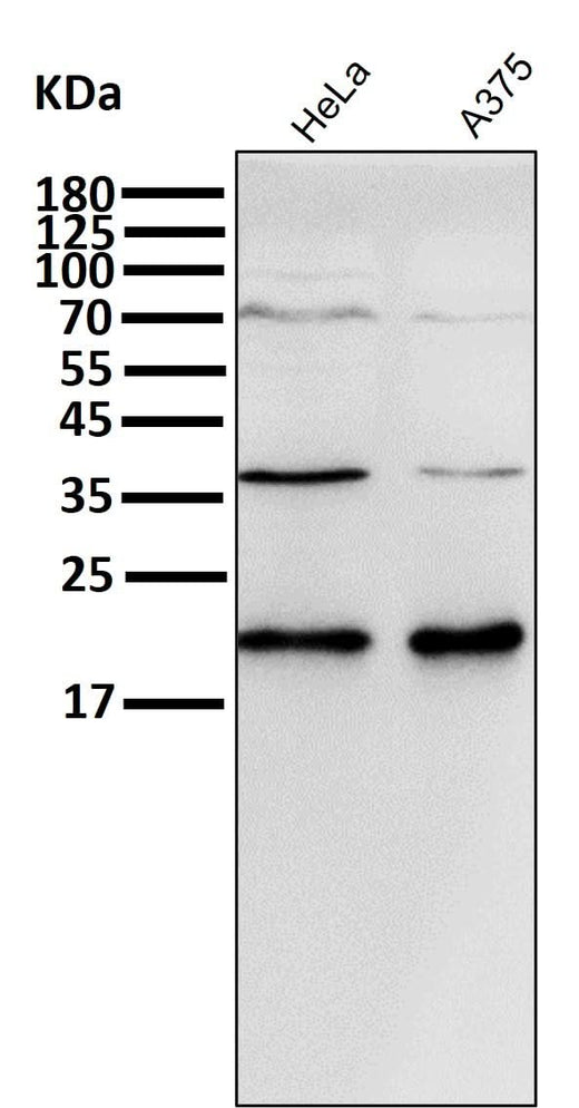 Anti-p21 CDKN1A Rabbit Monoclonal Antibody Boster Bio