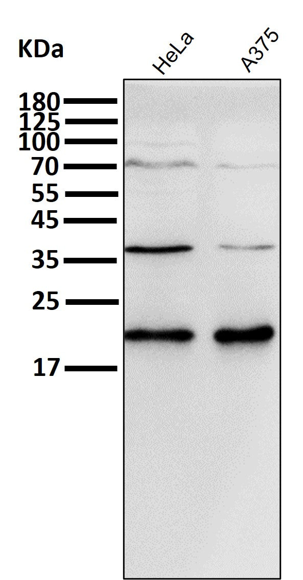 Anti-p21 CDKN1A Rabbit Monoclonal Antibody Boster Bio