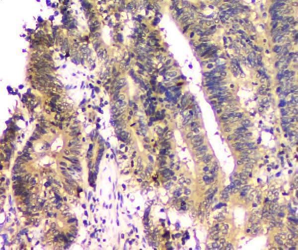 Anti-SHP2/PTPN11 Antibody Picoband® (monoclonal, 2E6 Boster Bio