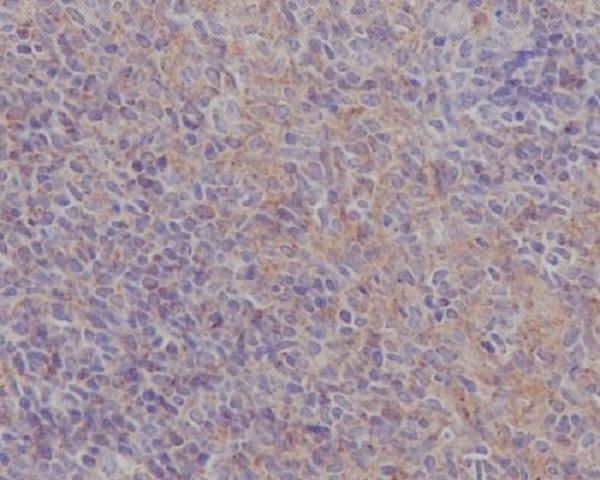 Anti-FAK PTK2 Rabbit Monoclonal Antibody Boster Bio