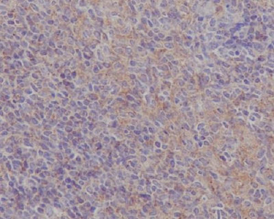 Anti-FAK PTK2 Rabbit Monoclonal Antibody Boster Bio