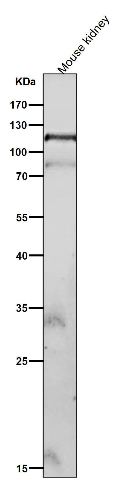 Anti-Phospho-FAK (Y576 + Y577) Rabbit Monoclonal Antibody Boster Bio