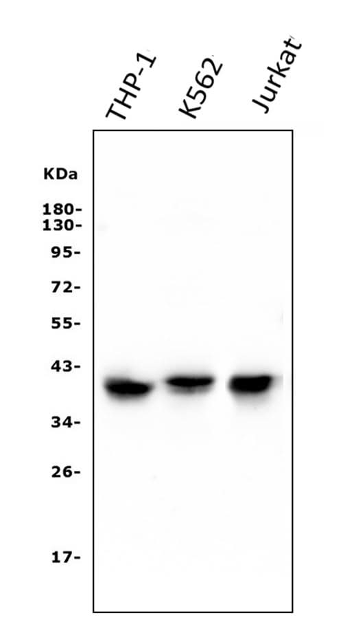 Anti-CCR2 Antibody Picoband® (monoclonal, 8C4 Boster Bio