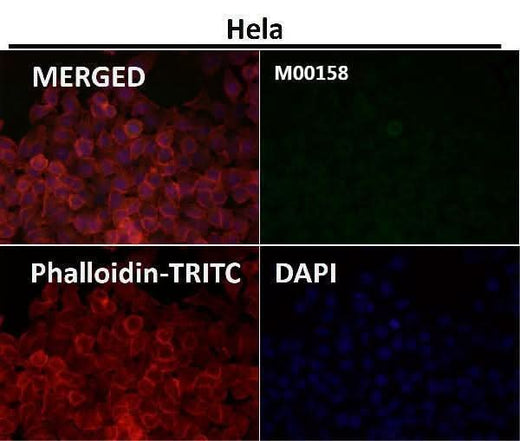 Anti-CCR2/CKR2 Rabbit Monoclonal Antibody Boster Bio