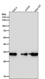 Anti-CDK4 Rabbit Monoclonal Antibody Boster Bio