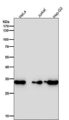 Anti-CDK4 Rabbit Monoclonal Antibody Boster Bio