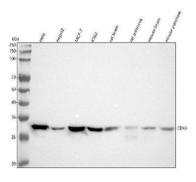 Anti-CDK4 Rabbit Monoclonal Antibody Boster Bio