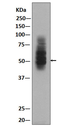 Anti-GLUT1 SLC2A1 Rabbit Monoclonal Antibody Boster Bio