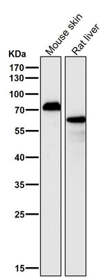 Anti-p63 TP63 Rabbit Monoclonal Antibody Boster Bio