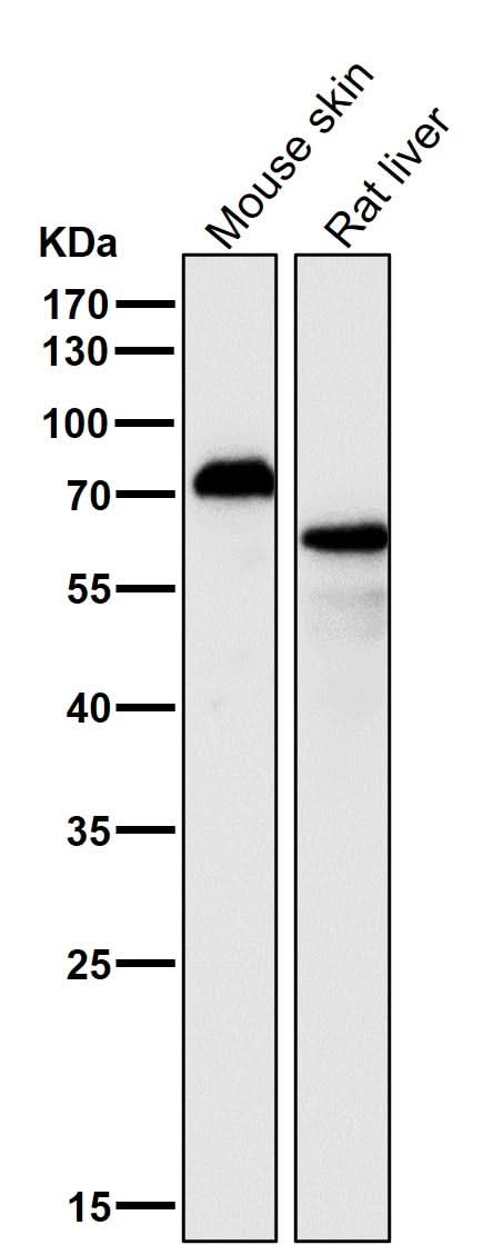 Anti-p63 TP63 Rabbit Monoclonal Antibody Boster Bio
