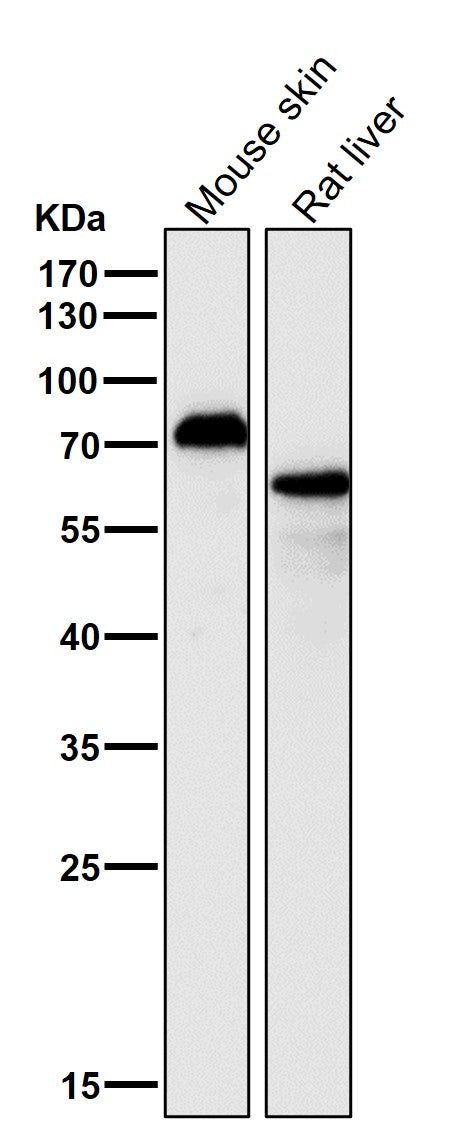 Anti-p63 TP63 Rabbit Monoclonal Antibody Boster Bio