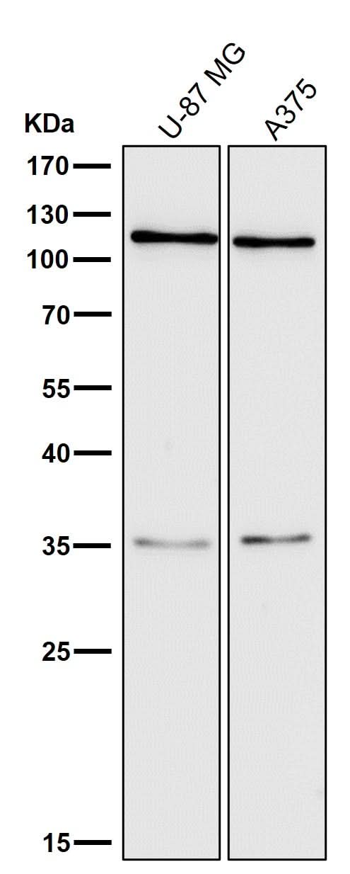 Anti-C3/Complement C3 Rabbit Monoclonal Antibody Boster Bio