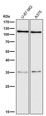 Anti-C3/Complement C3 Rabbit Monoclonal Antibody Boster Bio