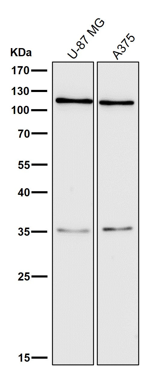 Anti-C3/Complement C3 Rabbit Monoclonal Antibody Boster Bio