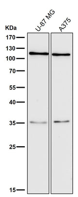 Anti-C3/Complement C3 Rabbit Monoclonal Antibody Boster Bio