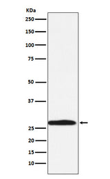 Anti-Carbonic Anhydrase 1 Rabbit Monoclonal Antibody Boster Bio