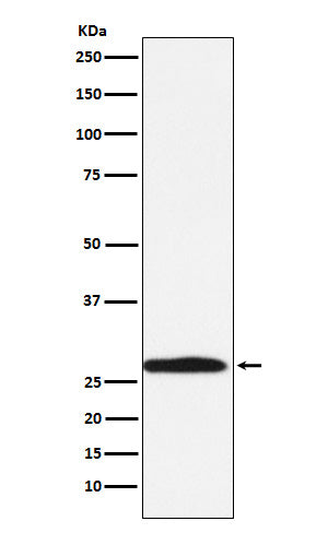 Anti-Carbonic Anhydrase 1 Rabbit Monoclonal Antibody Boster Bio