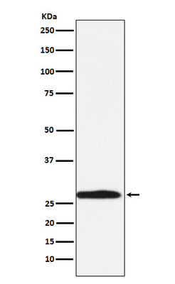 Anti-Carbonic Anhydrase 1 Rabbit Monoclonal Antibody Boster Bio