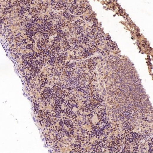 Anti-Dnmt1 Rabbit Monoclonal Antibody Boster Bio