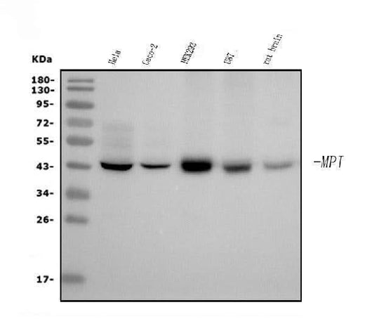 Anti-MPI Picoband® Antibody (monoclonal, 5G5 Boster Bio