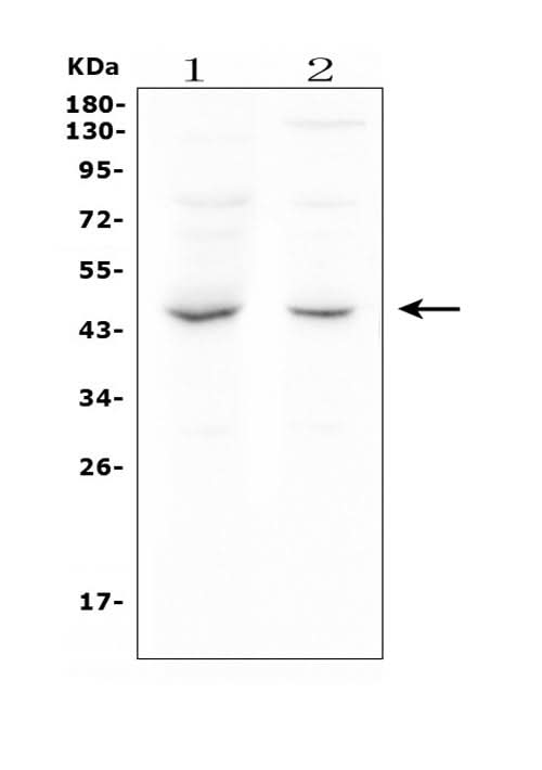 Anti-MPI Antibody Picoband® (monoclonal, 11I4 Boster Bio