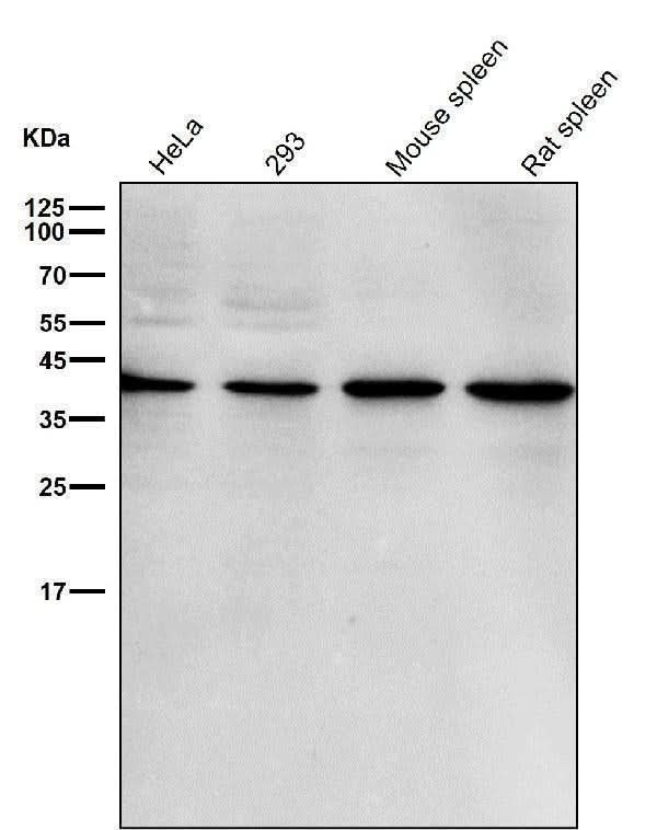 Anti-p38 MAPK14 Rabbit Monoclonal Antibody Boster Bio