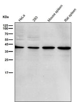 Anti-p38 MAPK14 Rabbit Monoclonal Antibody Boster Bio