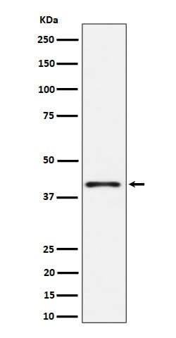Anti-Phospho-p38 (T180) Rabbit Monoclonal Antibody Boster Bio