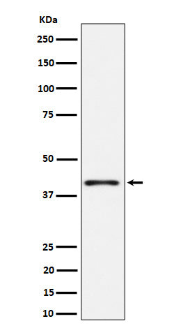 Anti-Phospho-p38 (T180) Rabbit Monoclonal Antibody Boster Bio
