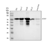 Anti-SOX9 Rabbit Monoclonal Antibody Boster Bio