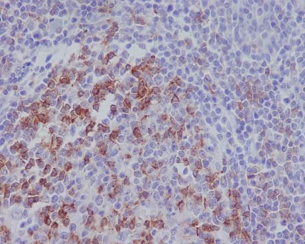 Anti-PD1 PDCD1 Rabbit Monoclonal Antibody Boster Bio