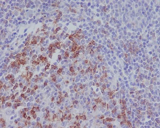 Anti-PD1 PDCD1 Rabbit Monoclonal Antibody Boster Bio