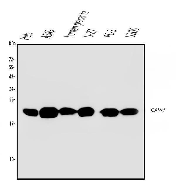 Anti-Caveolin-1/CAV1 Antibody Picoband® (monoclonal, 12C7 Boster Bio