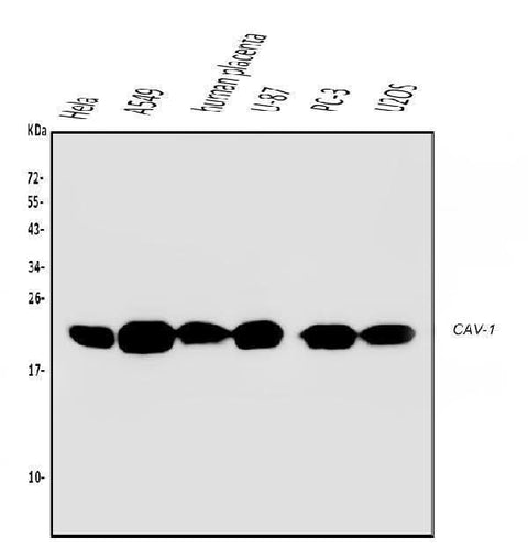 Anti-Caveolin-1/CAV1 Antibody Picoband® (monoclonal, 12C7 Boster Bio
