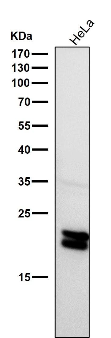 Anti-Caveolin-1 CAV1 Rabbit Monoclonal Antibody Boster Bio