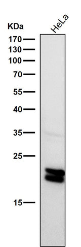 Anti-Caveolin-1 CAV1 Rabbit Monoclonal Antibody Boster Bio