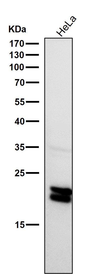 Anti-Caveolin-1 CAV1 Rabbit Monoclonal Antibody Boster Bio